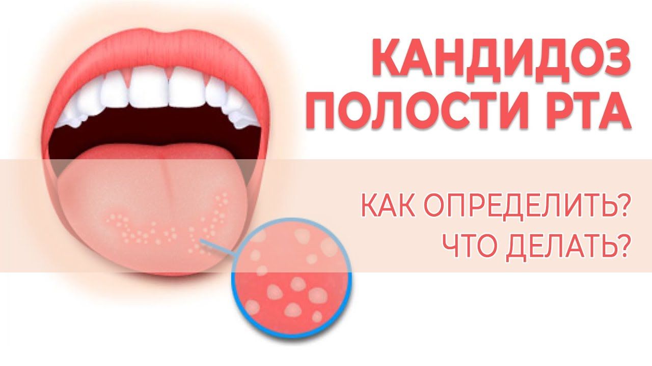 Амны мөөгөнцөр | Эмийн ургамал судлалын төв
